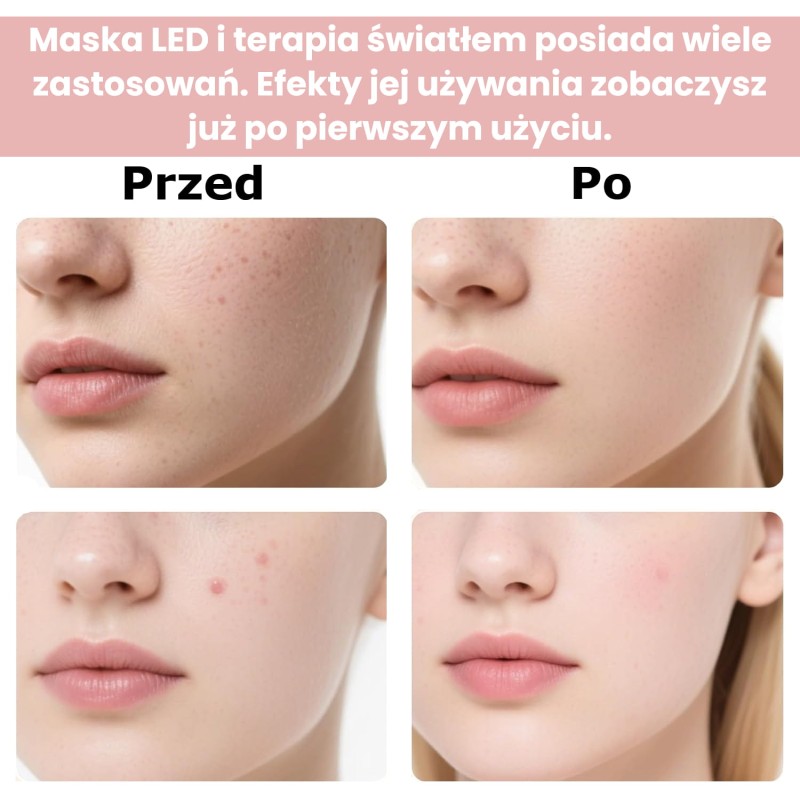 maska led 01.jpg